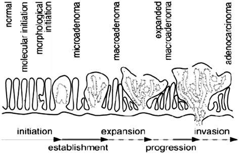 오도연 : Molecular Carcinogenesis in Colorectal Cancer 암에서 β-catenin을염색해보면상당히 heterogenous한양상으로핵내에염색이되는데, 종양의침윤성가장자리에는핵내염색이상당히강하게되는반면종양의중심부에서는주로세포질과세포막에염색이된다.