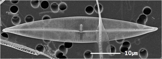 미기록 / 신분류군발굴 미기록분류군 신분류군 학명 Proschkinia bifurcata sp. nov.