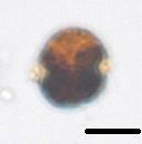 Kouseisha Kouseikaku, Tokyo, pp. 130. Iwataki M. 2008. Taxonomy and identification of the armored dinoflagellate genus Heterocapsa (Peridiniales, Dinophyceae). Plankton Benthos Res 3: 135-142.