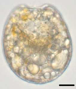 , Chomérat, N. & Horiguchi, T. 2014. Marine benthic dinoflagellates - unravelling their worldwide biodiversity. Kleine Senckenberg-Reihe Vol. 54. pp. 152 Fig. 63.