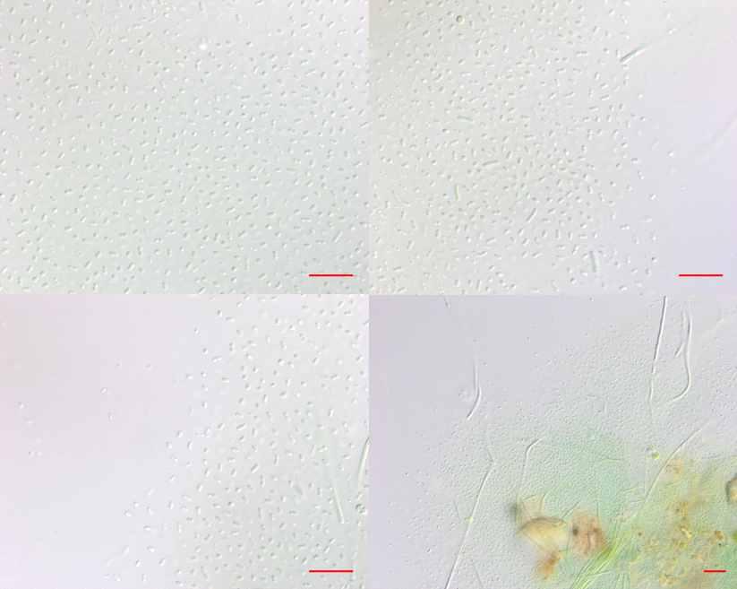 미기록 / 신분류군발굴 미기록분류군 신분류군 일련 번호 미세조류 2017 ( 이옥민 )-001 학명 Aphanothece smithii Komárková-Legnerová & G.