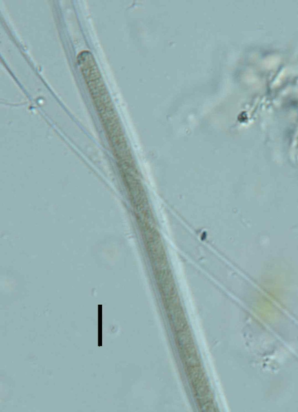 Süsswasserflora von Mitteleuropa. Cyanoprokaryota: 2. Teil/2nd Part: Oscillatoriales. Vol. 19. p. 632, fig. 971. 조체는단독성이고, 기질에부착하거나부유성이며, 올리브그린에서짙은녹색을띄거나약간의갈색을띈다. 조체는긴사상체이며, 직선상이거나만곡되어있다.