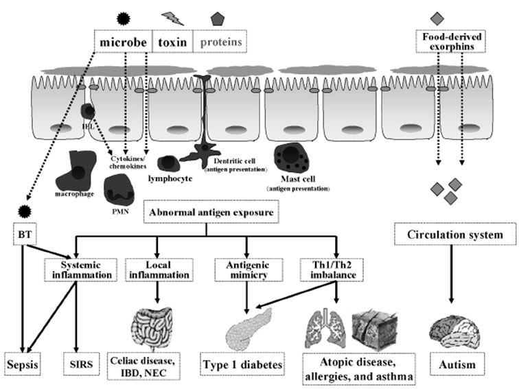 111 Complement and Integrative Approach in Gut Health and Immunologic Disease 식의섭취나중금속이나독성물질을섭취했을때, 지나치 게자극적인음식물의섭취나특정음식물에과민반응이있 는경우, 알코올의과량복용, 다발성외상, 급.