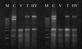 Fig. 33. dsrna forms isolated from hyphal fused strains.