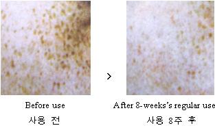 Skin Brightening & Lightening / 피부미백 Naor 의에센스와데이, 나이트크림은, 여러기능과함께, 밝고하얀피부를위하여집중적으로개발된제품으로, 사용약 2-3 주후부터는스스로얼굴피부가하얗게밝아짐을느끼게되며,