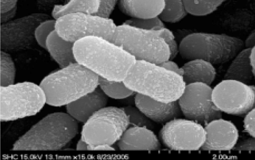 144 Chan-S Park et al. Kr. J. Micrbil (13,000 rpm, 10분)하였으며, 상등액에 존재하는 환원당을 DNS (dinitrsalicylic acid)법(13)으로 정량하여 효소 활성을 측정하였 다.