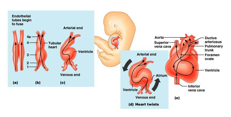 선천성심장질환 (Congenital Heart