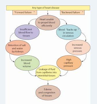 심장부전 (Heart Failure) 충분한양의혈액을조직에펌프하지못할때발생 모든심장질환이원인이된다 심장부전의병리생리전방부전 (Forward failure): 낮은심박출량