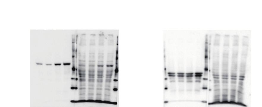 One-step RT Kit cdna 합성과 PCR 을한번에!