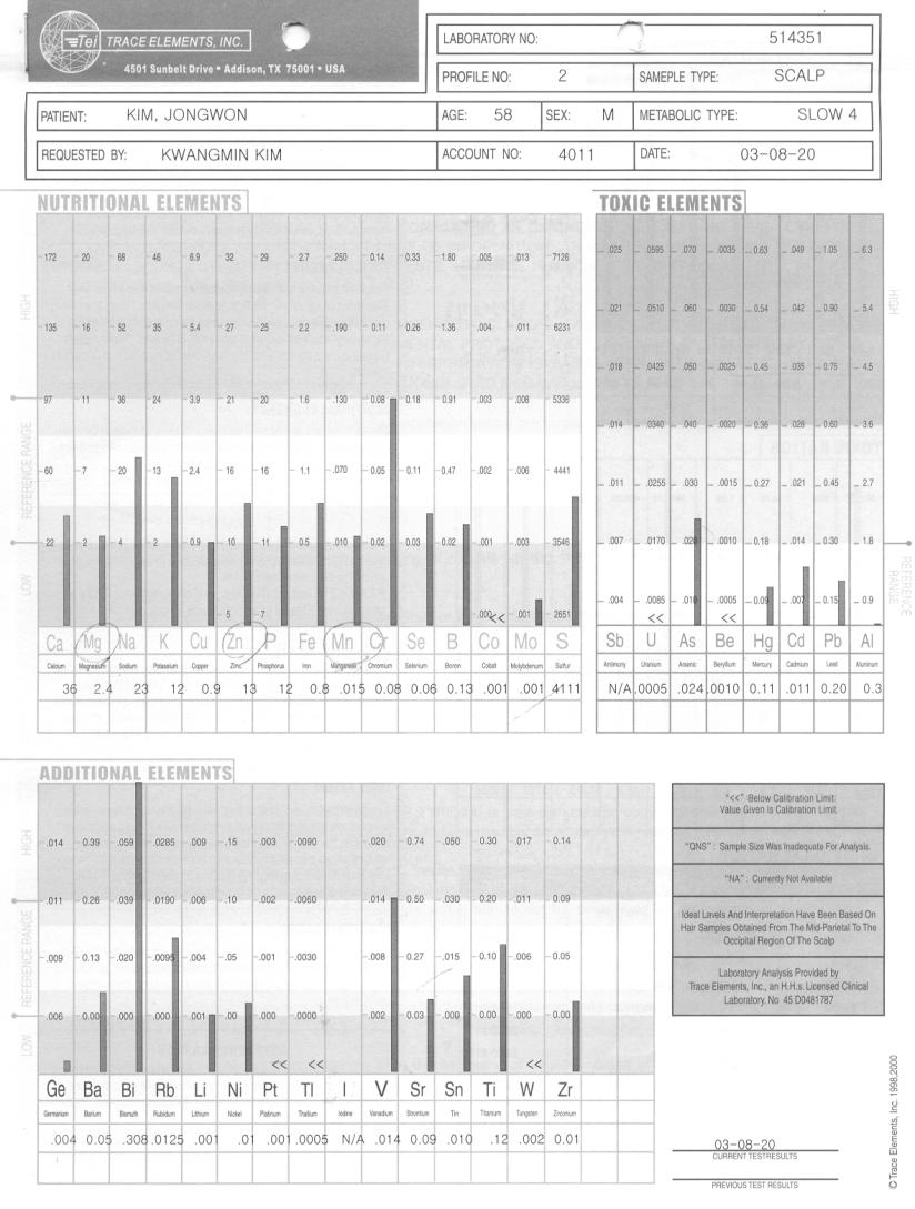 대한임상건강증진학회 2014 추계학술대회 TMA(Tissue Mineral Analysis) TMA (Tissue Mineral Analysis) 해석방법 미네랄결핍및과잉은혈액검사나소변검사에서보다조직미네랄검사 (TMA) 에서쉽게관찰 모발이가장적절 : 모근에서혈액의미네랄정보를받아, 다시혈액에반작용을하지않고하루에 0.