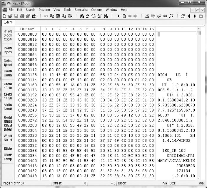 Jeongku Kang and Dong Joon Lee:Development of DICOM Convert Program for the Geant4 Monte Carlo Simulation of the Radiotherapy 결과전산모사에서 DICOM