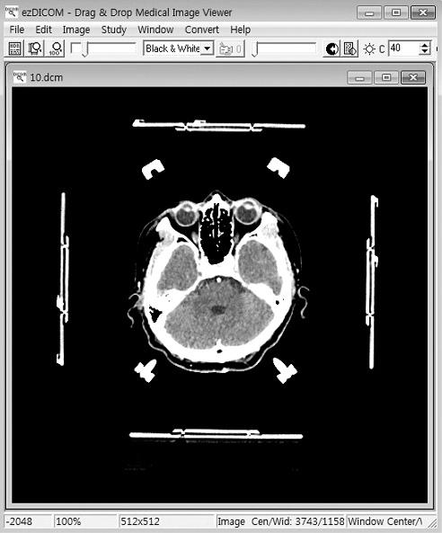 PROGRESS in MEDICAL PHYSICS Vol. 24, No. 4, December, 2013 Fig. 4. Evaluation of converted meta files.