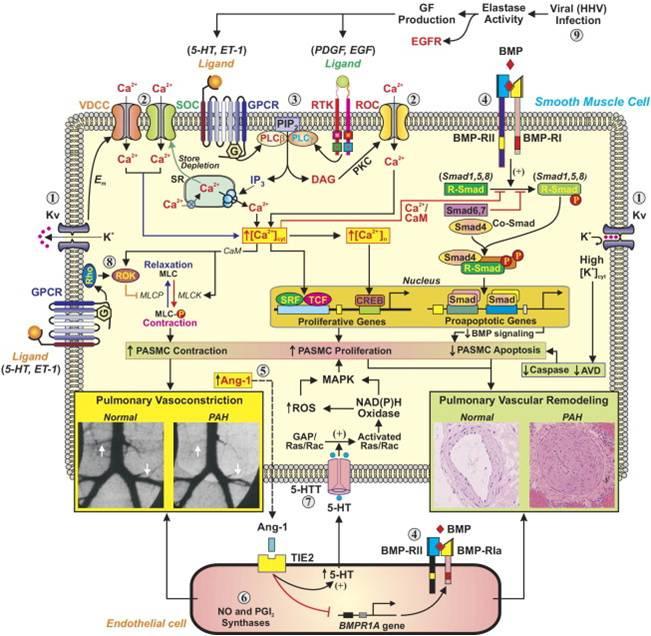 - 대한내과학회지 : 제 78 권제 1 호통권제 593 호 2010 - Figure 2. Schematic diagram depicting potential mechanisms involved in the development of pulmonary arterial hypertension.