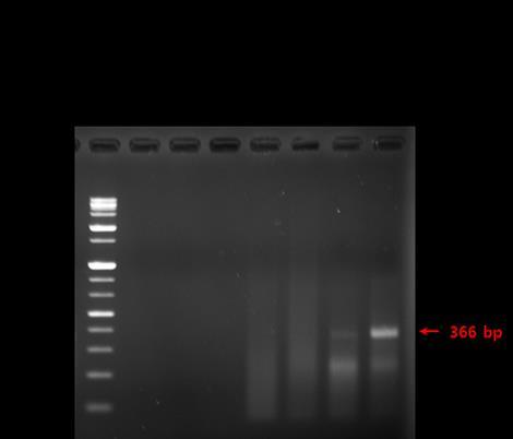 Figure 3. PCR products of 5'-RACE from HeLa total RNA 2-1. 3 RACE 실험방법 1) 첫번째 cdna 합성 1 아래의조성표대로구성성분을혼합하고원심분리를짧게합니다.