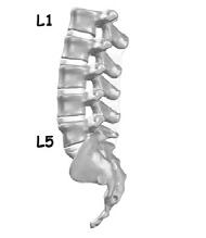 Middle back or thoracic spine Outward Kyphosis 3.