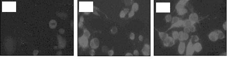 (165) A B C Fig. 1. Reduction of intracellular peroxide by -amyloid-treated Neuro 2A cells. Cells were treated with -amyloid in Neuro 2A cells for 6 hr.