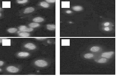 (166) 26 1(2005 3) A B C D a b c d Fig. 4. Pretreatment of Neuro 2A cells with SWS prevented the cytotoxicity and morphological change by H2O2.