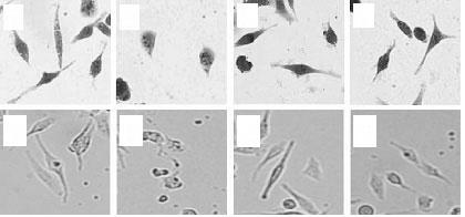 (A, a), control cells. (B, b), cells treated with H2O2. (C, c), cells treated with SWS and (D, d), cells pretreated with SWS before H2O2. A B C D Fig. 5.