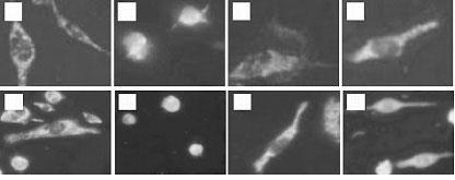 SWS inhibited the decrease in Bcl-XL expression as well as increase in Bcl-XS expression and SWS inhibited the degradation ICAD/DFF45 in H2O2-treated Neuro 2A cells.