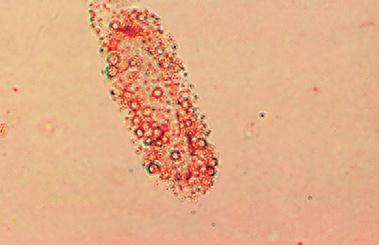 40 J Korean Soc Pediatr Nephrol Vol.