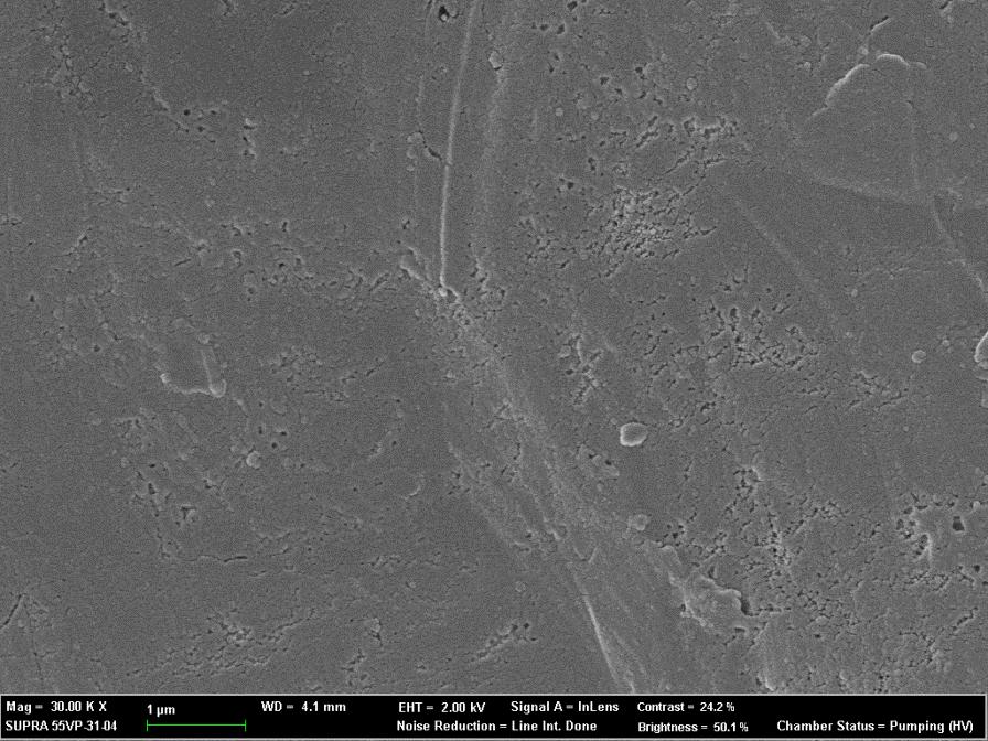Inner surface 1 µm