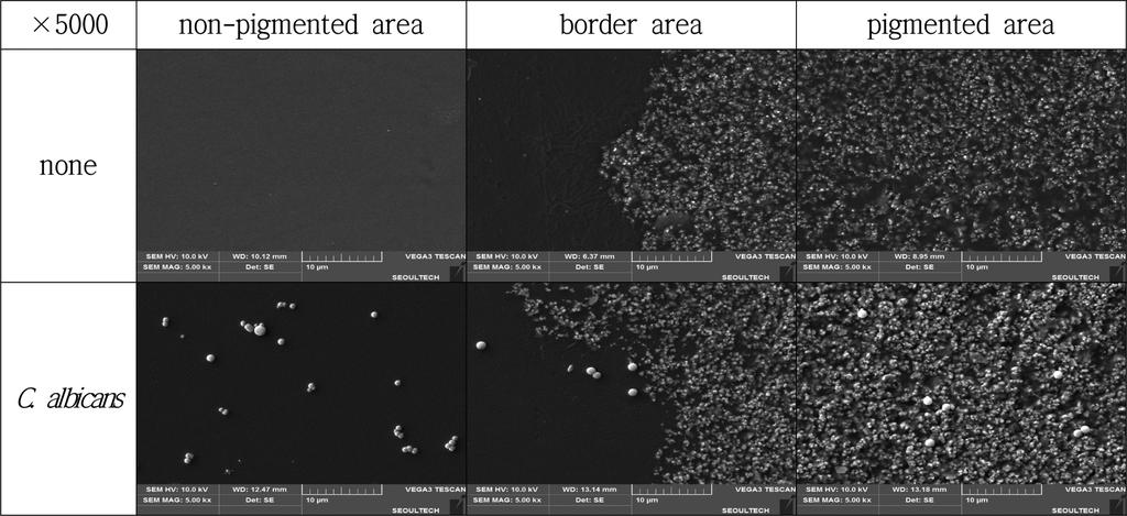 Deposition of Tear Constituents and the Adherence of Candida albicans 219 Fig. 4. The representative pictures of C.