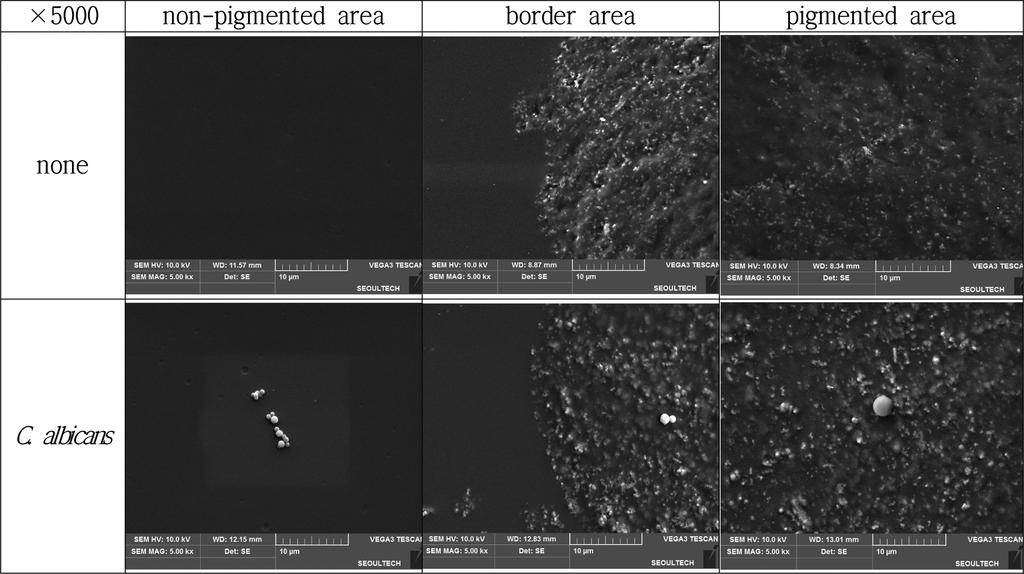 albicans adsorption on non-pigmented, pigmented and border areas of circle contact lenses made of nelfilcon A taken by SEM( 5000). 표면상으로는 투명부위와 차이가 없었으나 칸디다균의 흡 부는 0.064±0.042 cfu/mm2, 착색부는 0.008±0.