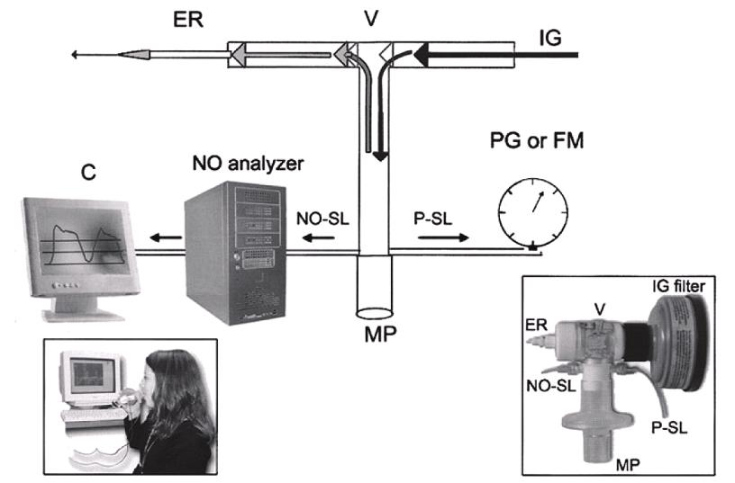 The Korean Journal of Medicine : Vol. 74, No. 6, 2008 Figure 1. Diagram of a configuration for the breathing circuit for measurement of FeNO 11).