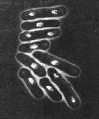 해로운박테리아의생장저해 Pathogenic 은 sickness, death 유발 - 돌연변이잘유발