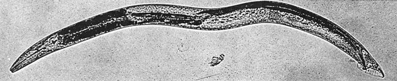 select - yeast survive in media lacking leucine - selected yeast cells