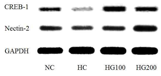 p<0.01 compared with HC group. p<0.05 compared with HC group. mrna pathway CREB-1 Nectin-2 mrna heat stress (p<0.01) GINST heat stress CREB-1 Nectin-2 mrna (p<0.05) Fig. 28.