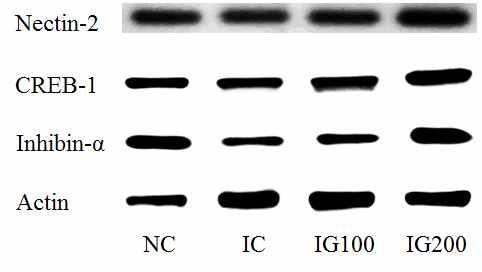 Data are expressed as mean ± S.E.M. (n=10). Statistical analysis was carried out by Student's t-test and one way ANOVA using GraphPad Prism version 4.0. NC: normal control; IC: immobilization-stressed control; IG100: immobilization-stressed and received GINST 100 mg/kg b.