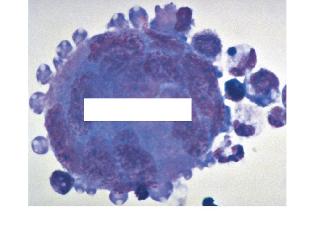 platelets megakaryocyte (c) Megakaryocyte