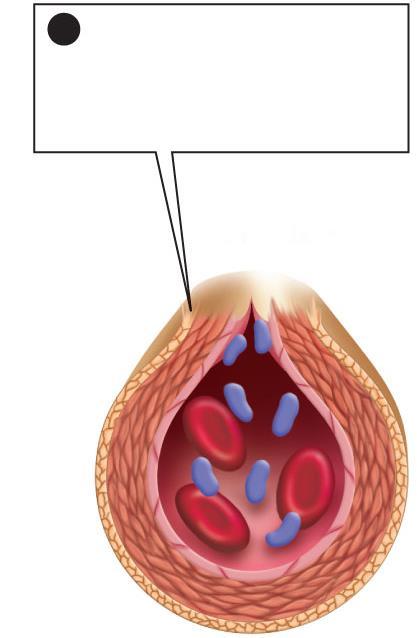 Step 2 1 Damaged cells expose collagen, which activates platelets, causing them to stick and form