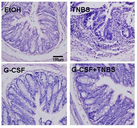 16 Eun-Young Choi, et al. A B Histologic Score 10 8 6 4 2 0 TNBS - + - + G-CSF - - + + Figure 3. G-CSF ameliorates the histopathologic features of TNBS-induced colitis.