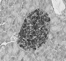 Effect of fermented ycon leves te wter extrct supplementtion on heptic glucose metolic enzymes ctivities in HFD/ STZ- induced dietic mice* Low-Ycon LWE High-Ycon LWE GK (nmol/min/mg protein) 15.