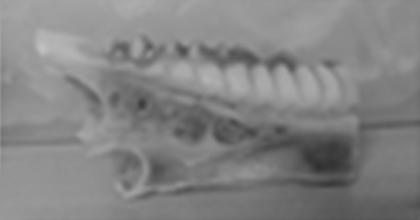 이를통해서실제치아의해부학적구조인치관 (crown), 치근 (root), 치수강 (pilp cavity), 치조골 (alveolar bone) 을확인하였다.