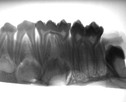 Yunseo Ji, et al:dosimetric Evaluation of a Small Intraoral X-ray Tube for Dental Imaging EXARO, 제조사 : HIOSSEN) 에서촬영한돼지턱뼈팬텀영상과비교해보았다.