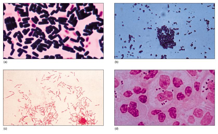 Gram stained microorganism (a) Clostridium perfringens(x800), (b)