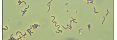 Staphylococcus * 간균