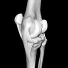 condition KNEE JOINT Hinge joint Unstable joint ligaments Extensor Flexor Rotator