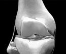 Cartilage ACL PCL ACL Incidence(USA): 1/3000, 95,000 new ACL injury/yr 50,000 knee reconstruction/yr 2,000 article published/20yrs 210