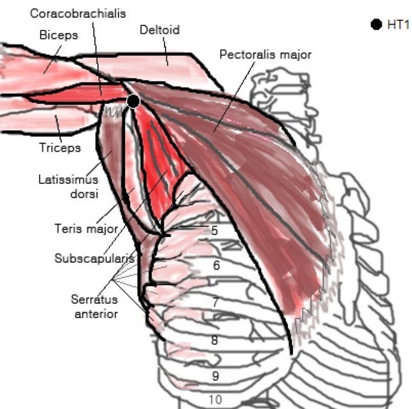KOREAN JOURNAL OF 극천 (HT1) 의취혈과활용에대한연구 하여고전에기재된것과유사하나 큰가슴근의끝부분 이라는근육의언급이있으며, < 針灸學簡編 >에서는 체표정혈법상겨드랑오목에있으며, 위팔뼈머리아래방향으로부리위팔근 (Coracobrachialis m.) 과위팔세갈래근 (triceps brachii m.) 의함몰처이다 9).