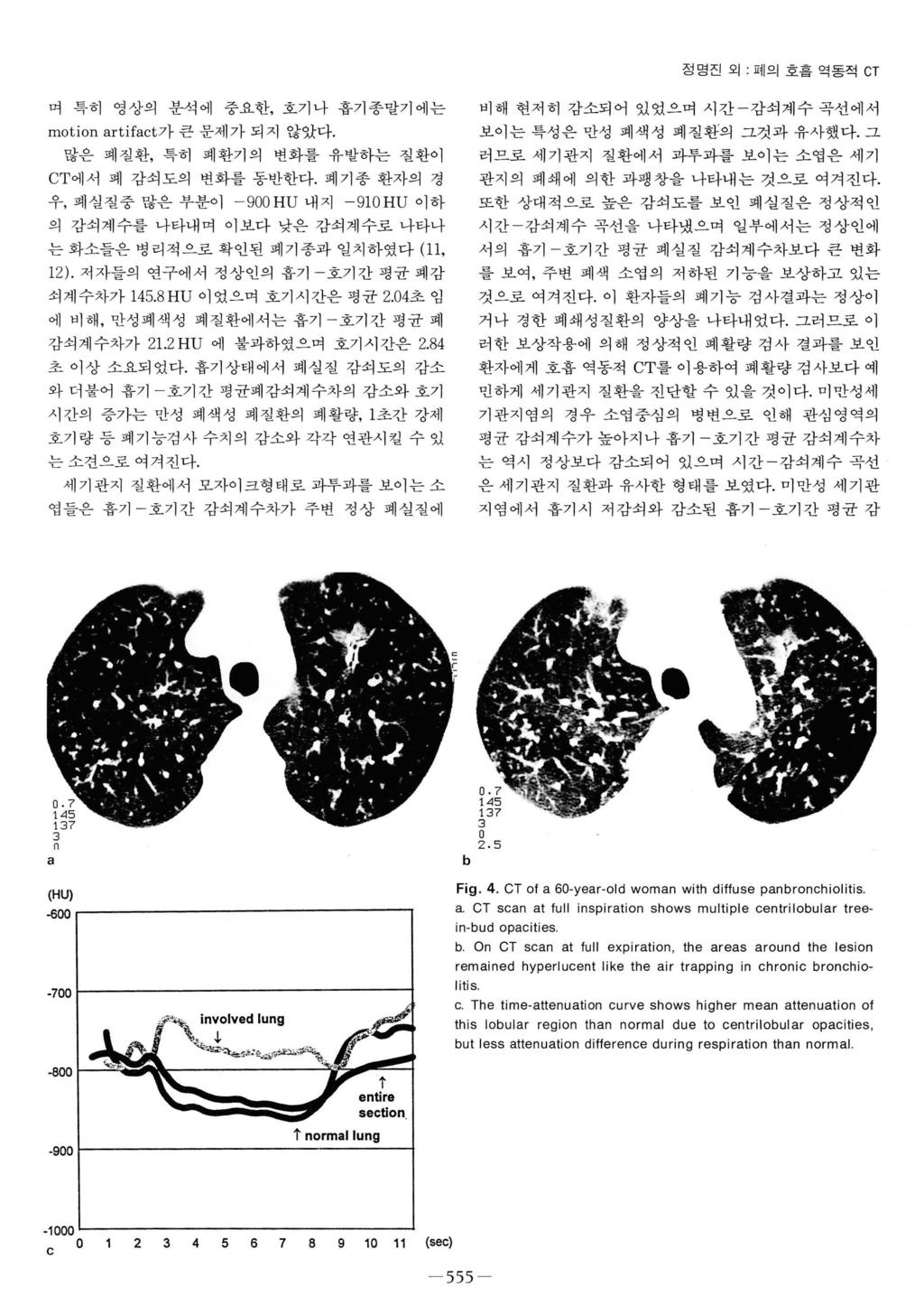 정명진외 : 폐의호흘염동적 CT 며특히영상의분석에중요한, 호기나흡기종말기에는 motion artifact가큰문제가되지않았다. 많은폐질환, 특히폐환기의변화를유발하는질환이 CT에서폐감쇠도의변화를동반한다.