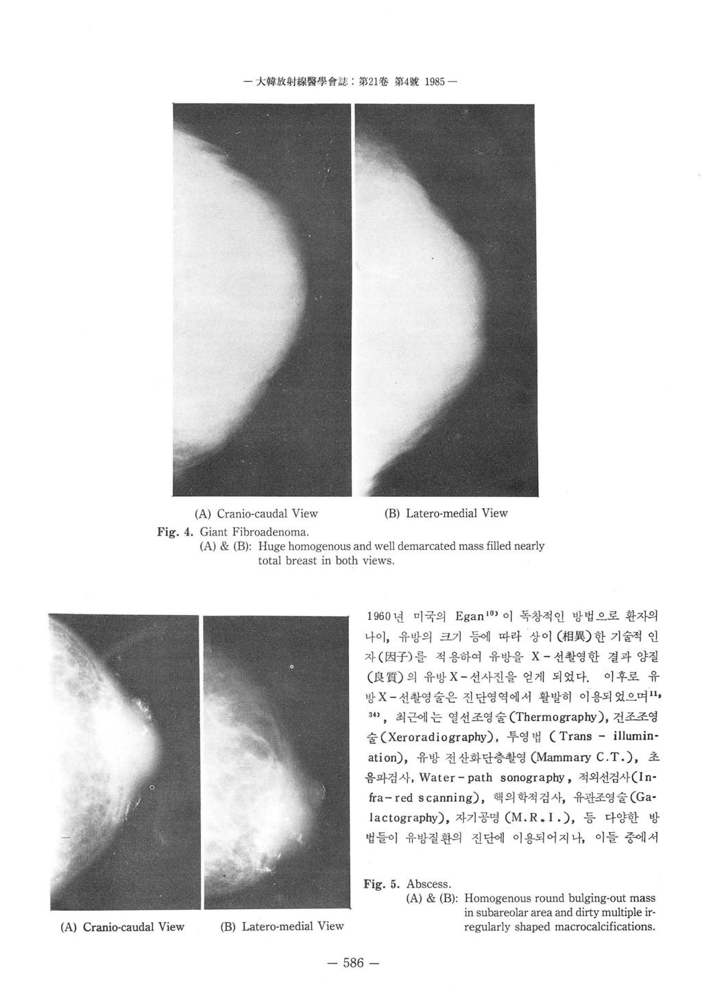 - 大합放射線뽑學會誌 第 1 卷짖 4 