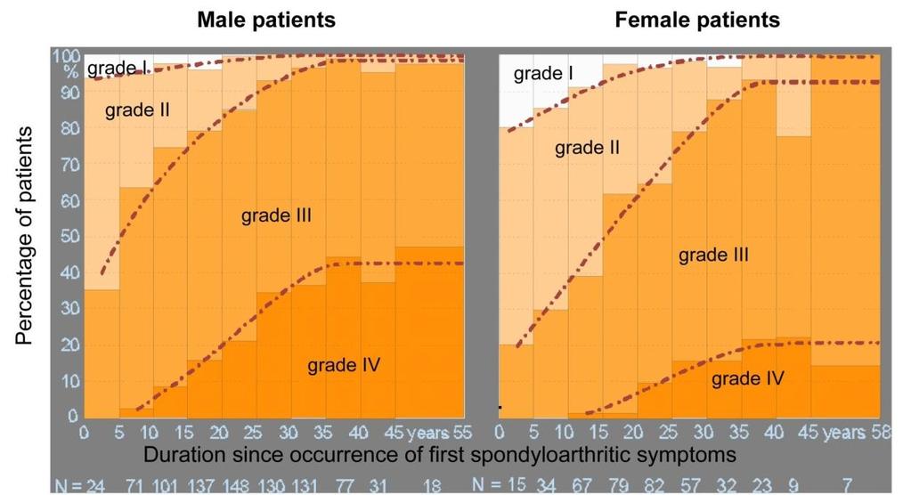 AS in female Structural damage of spine: Male > female Female: more frequent involvement in