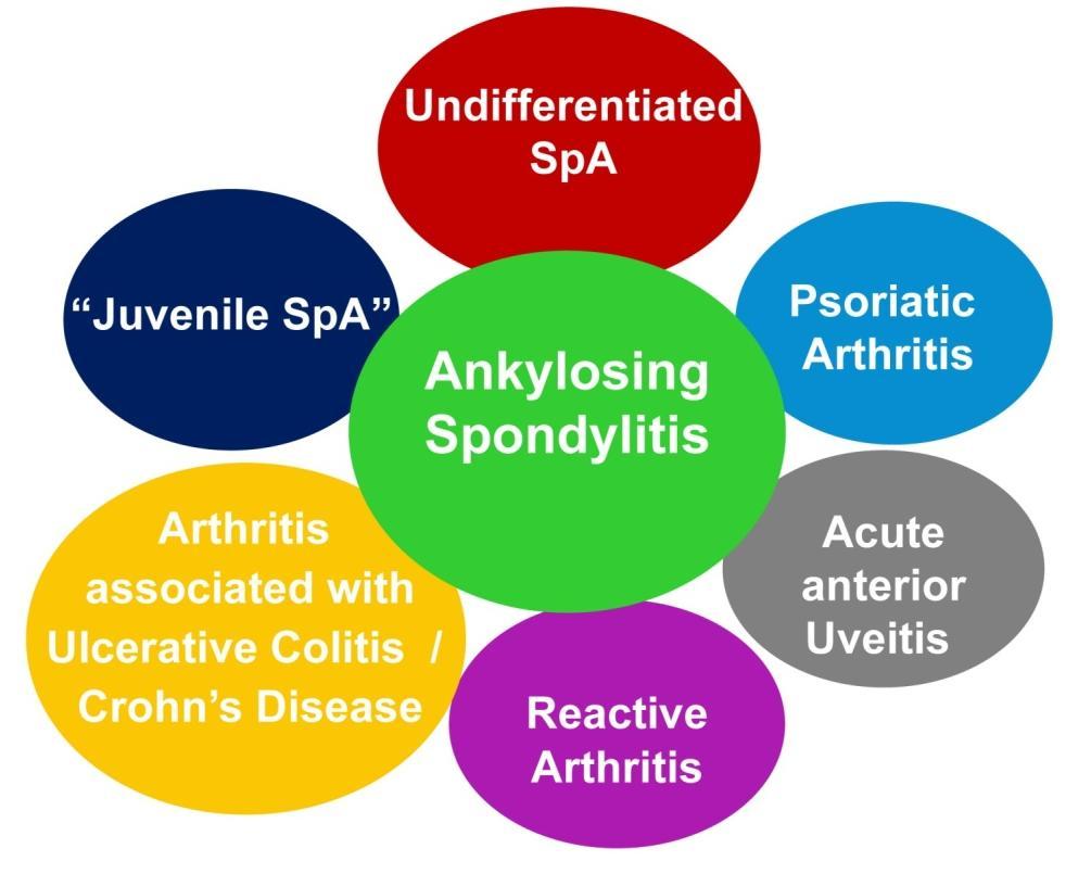 Concept of spondyloarthritis (SpA) Characteristics of SpA Axial arthritis (sacroiliitis,