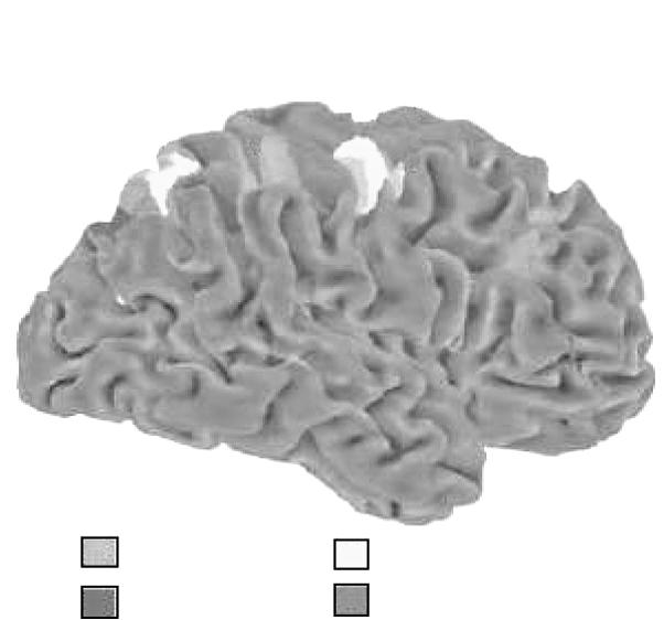 Brain& NeuroRehabilitation:2009; 2: 39~45 성화되는뇌부위를분석하면자극유도조절에관여하는뇌부위를알아볼수있다. 즉선행정보에의해미리활성화된정보처리신경회로에부합되지않는목표가제시되면이자극에의해새로운목표를분석하기위한선택적주의가일어나게된다.