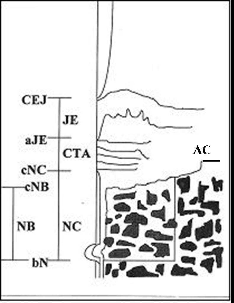 4) 신생백악질형성량 (NC):referencenotch(N) 기저부에서신생백악질최상단까지의거리 5) 신생골형성높이 (NB):reference notch(n) 기저부에서신생골최상단까지의거리 CEJ:cementoenameljunction AC:alveolarcrest aje:apicalextentofjunctionalepithelium