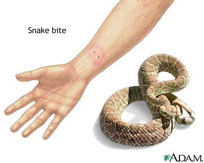 Snake Bite Identification of